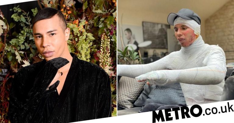 Oliver Rousteing reveals severe burns from fireplace explosion