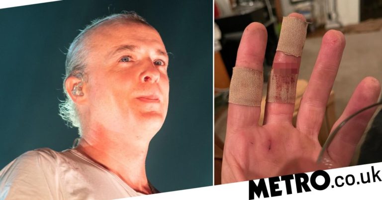 Travis singer Fran Healy reveals wounds after sausage dog ‘mauls’ hand