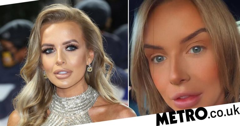 Love Island’s Faye Winter nervous as she gets lip fillers dissolved