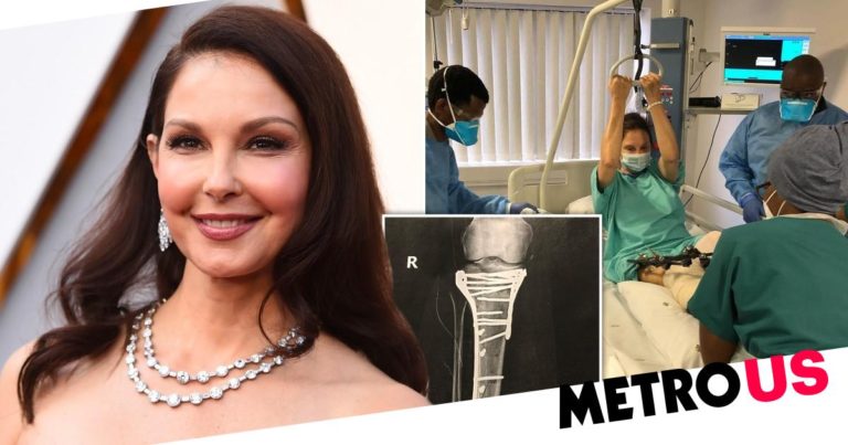 Ashley Judd ‘almost bled to death’ after shattering leg in the Congo